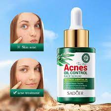30ml Tea Tree Acne Oil Control Serum